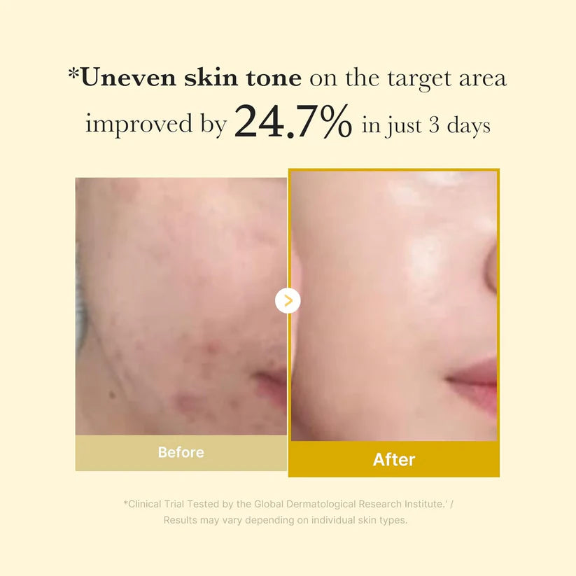 Medicube Kojic Acid Turmeric Wrapping Mask