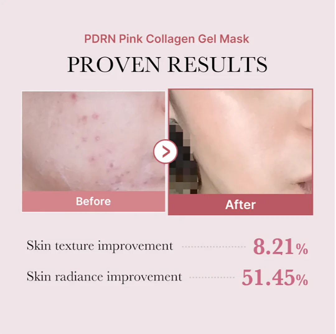 Medicube PDRN Pink Collagen Jelly Gel Mask
