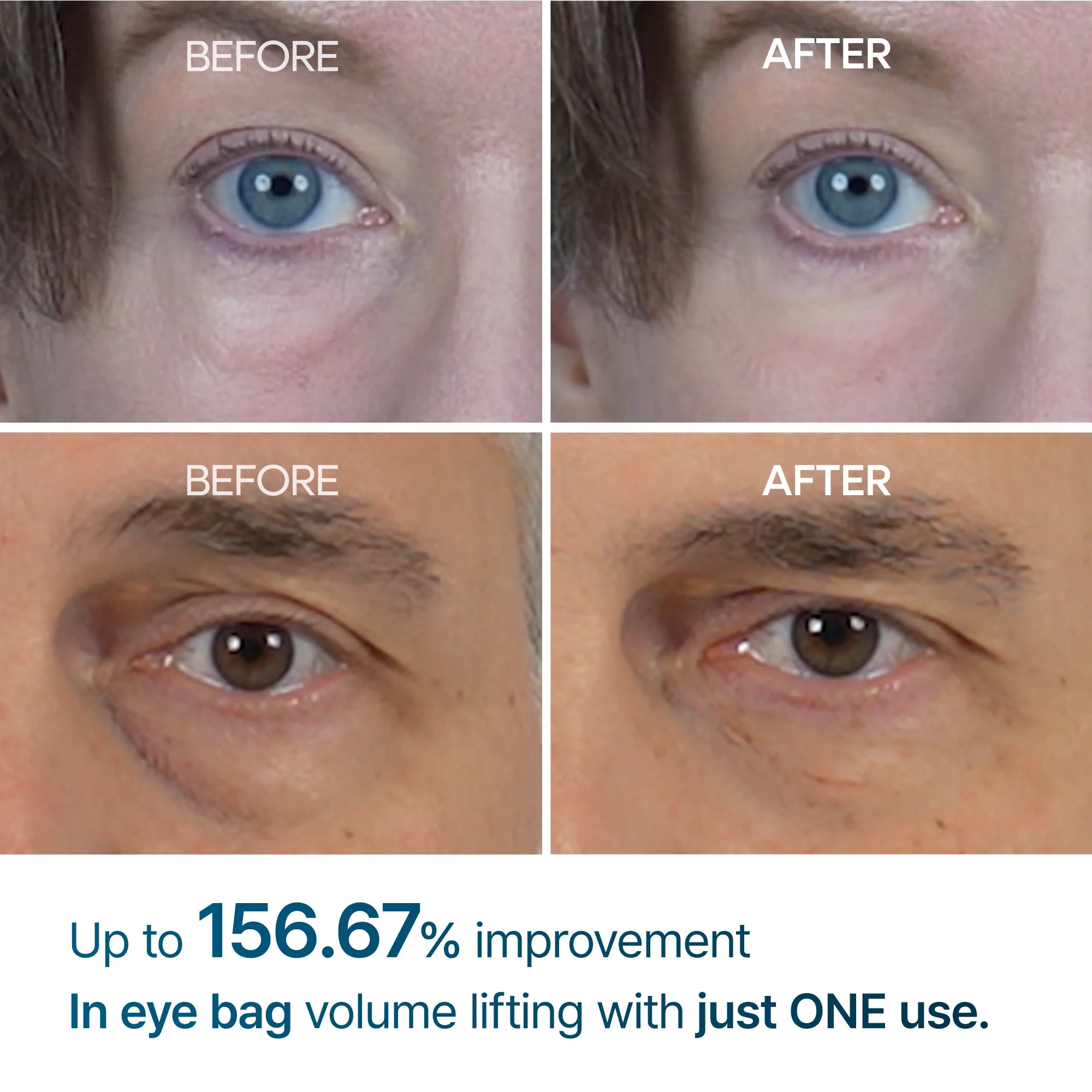 Dr. Melaxin Eyephalt Eye Bag Cream