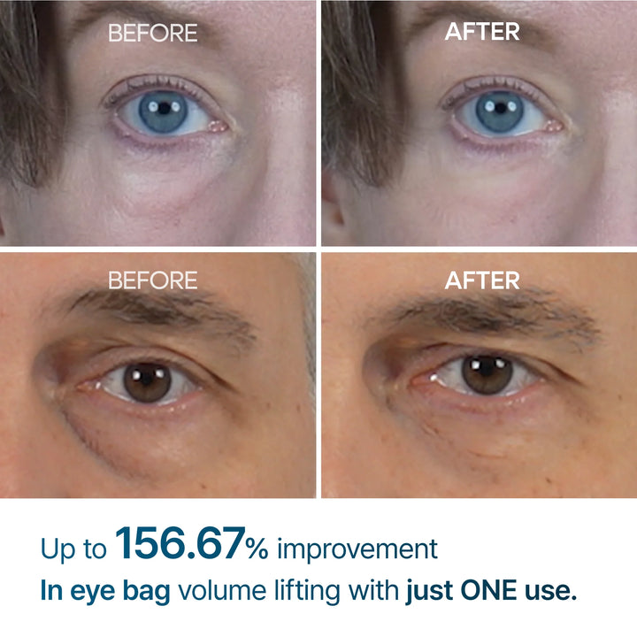 Translation missing: en.Dr. Melaxin Eyephalt Eye Bag Cream